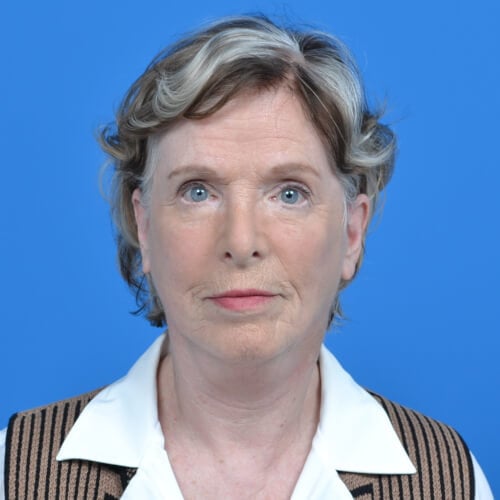 Facelift after front 0202