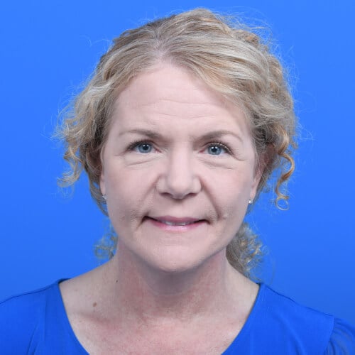 Facelift-necklift-after-front-0113