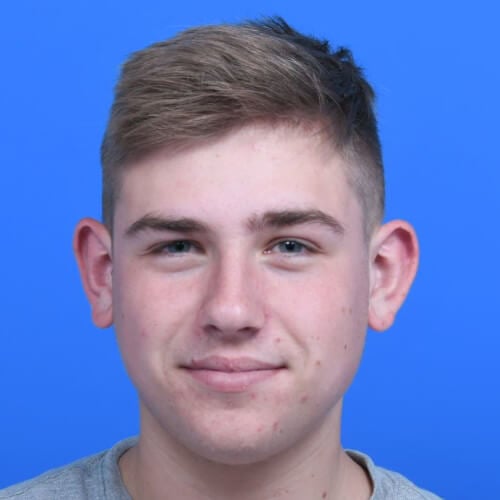 Otoplasty before front 16 year old