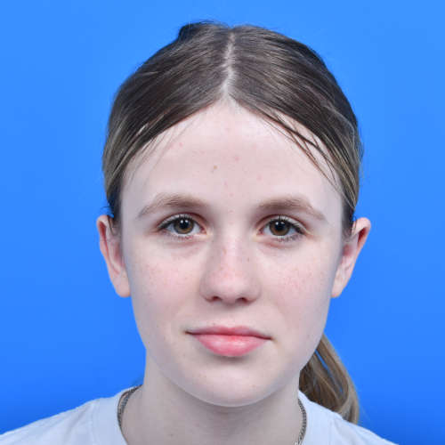 Otoplasty 14yo after front