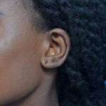 Earlobe left oblique before