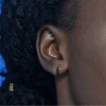 Earlobe right oblique before