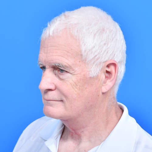 Neck lift tzplasty lo after