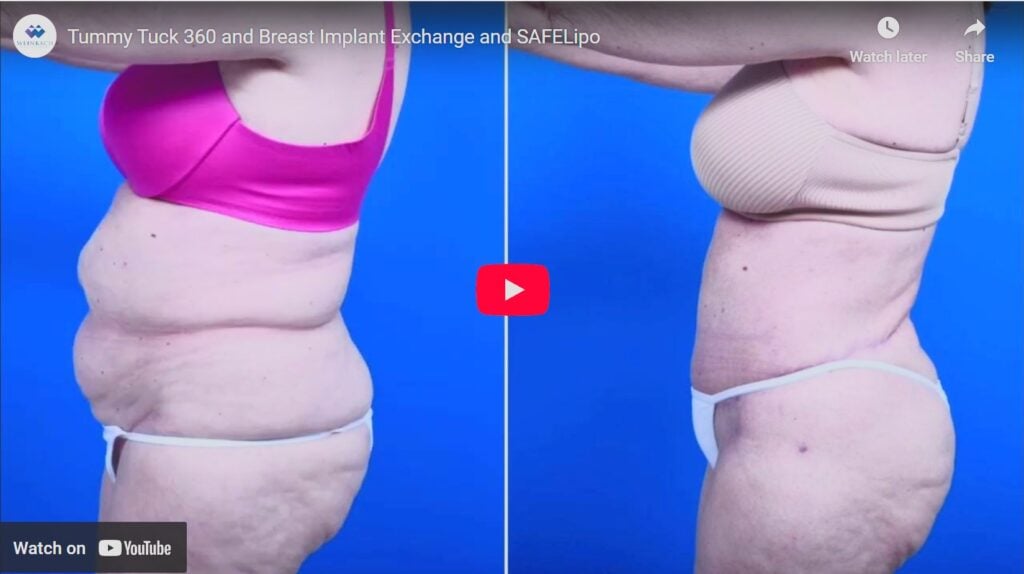 what happens when you swallow chewing tobacco spit Chewing Tobacco
