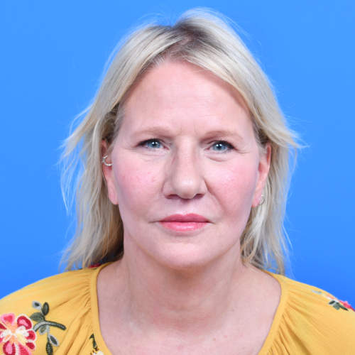 Facelift liplift eyelids front after