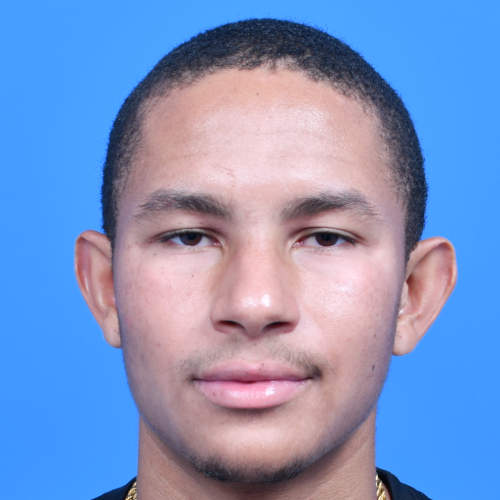 Otoplasty front before